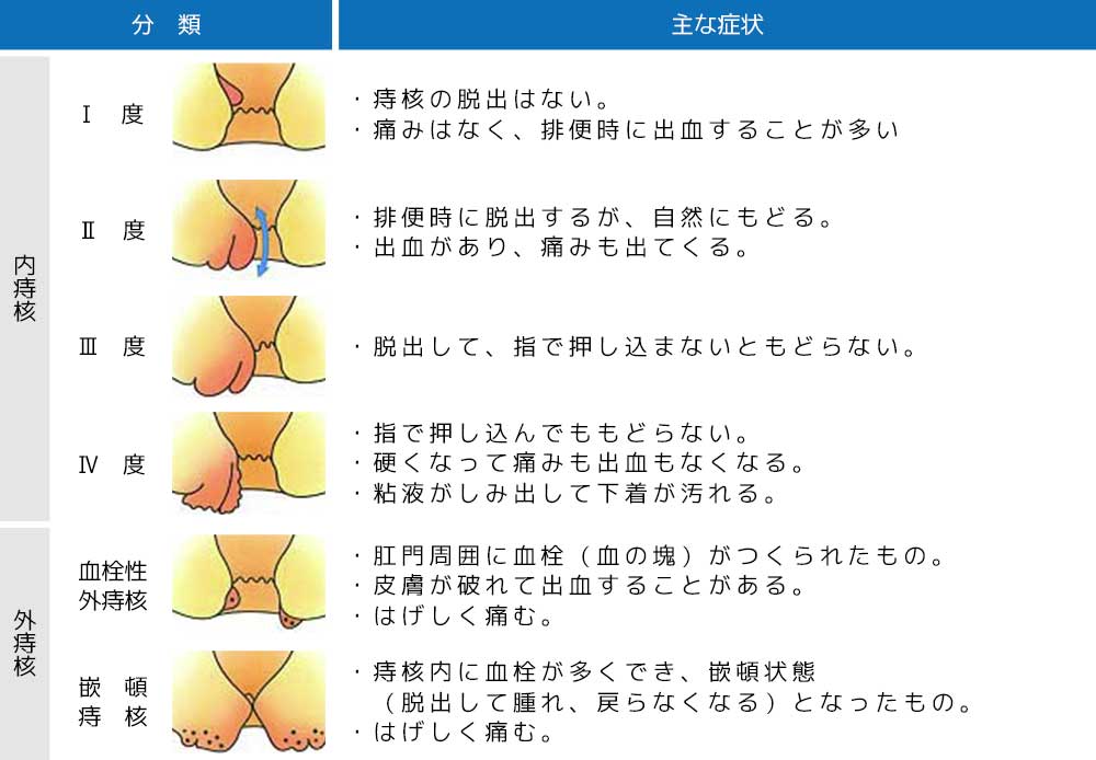 肛門科 | 青松記念病院 | 大阪府泉佐野市にある地域密着型の病院です。